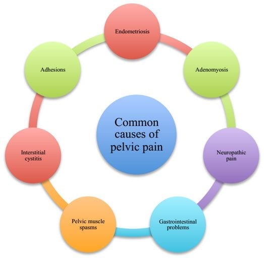 common-causes-of-pelvic-pain2 common-causes-of-pelvic-pain2